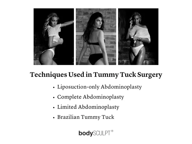 Tummy Tuck Surgery