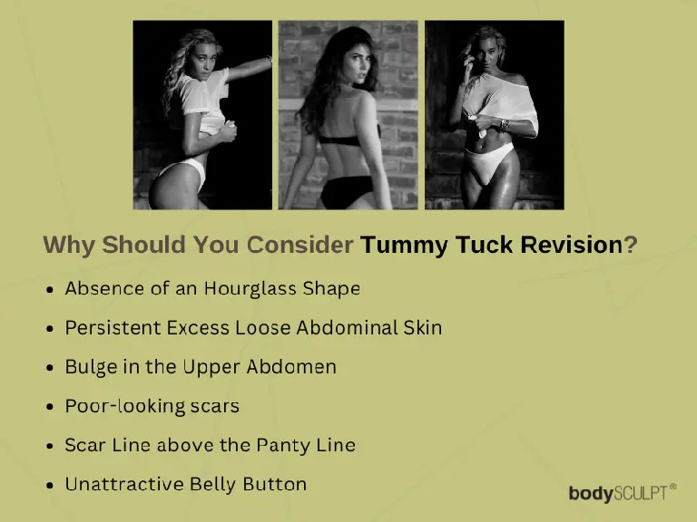 Tummy Tuck Revision